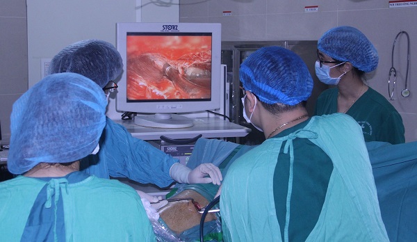 Phẫu thuật nội soi cắt một phần thùy phổi, kén - nang phổi cho bệnh nhân tràn dịch màng phổi do lao.